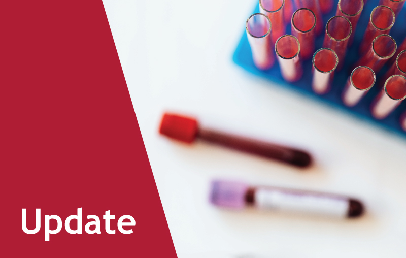 Second Sample Policy Update